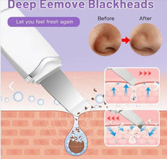 DEPURADOR ULTRASÓNICO FACIAL — Limpieza profunda, piel radiante